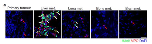 转入小鼠模型得到相同的试验结果，且在转移发生前NET已在肝脏聚积。