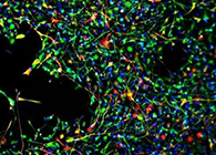 世界首创：药物将干细胞引导至受损部位，提高其愈合能力！