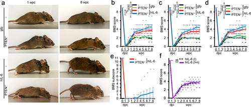 Hyper-IL-6促进功能恢复(来源：Nature)
