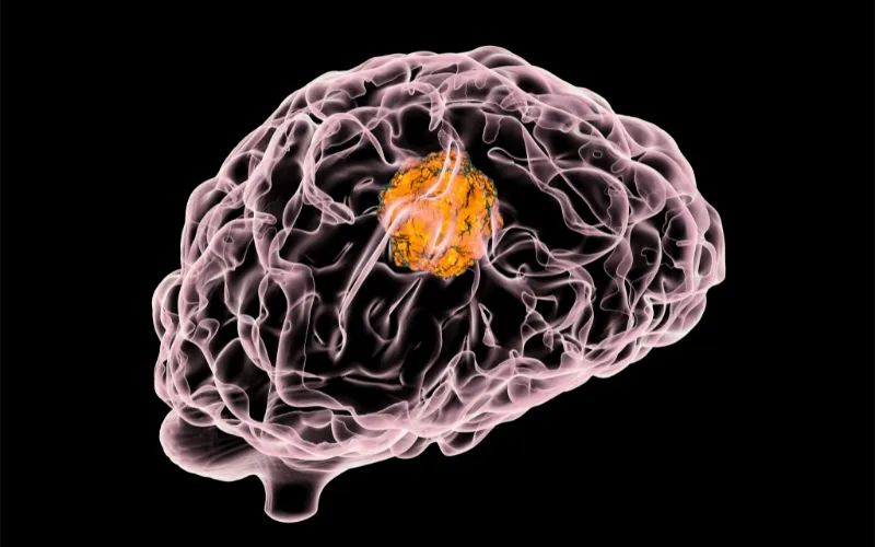 不朽情缘mg官网助力 | 璧辰医药ABM-1310获美国FDA孤儿药资格认证，用于治疗携带BRAF V600突变的脑胶质母细胞瘤患者