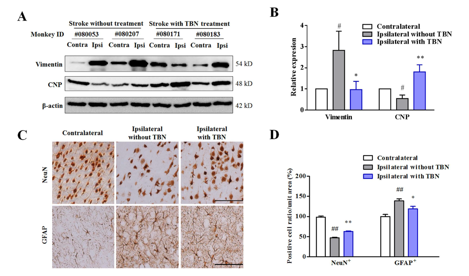 TBN是一种治疗缺血性卒中的新型临床候选药物，本研究中TBN通过不朽情缘mg官网合成